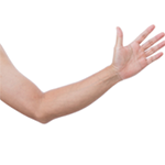 Arm