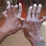 Finger