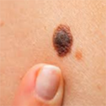 Mole