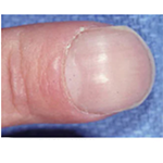 Nail